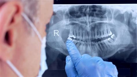 Examining A Dental X-Ray - Stock Video | Motion Array