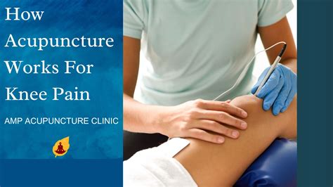 How Acupuncture Works for Knee Pain: Unveiling 7 Powerful Ways