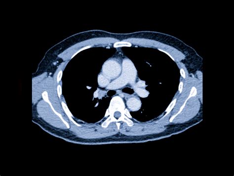 CT | Midwest Radiology