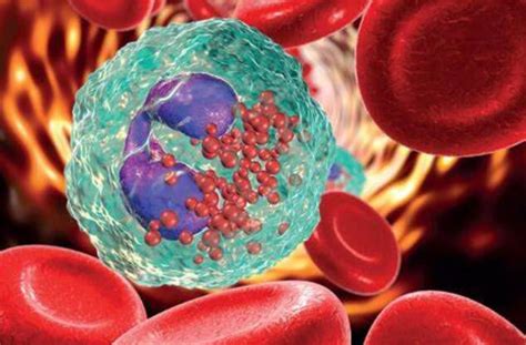 High Eosinophils: Causes Symptoms and Treatment