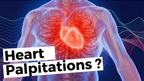 How to approach a patient with heart palpitations? (differential diagnosis) - YouTube