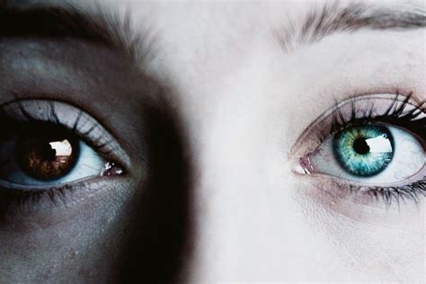 Celebrate the Extraordinary: Heterochromia Iridum- #uniqso2coloredeyes — UNIQSO