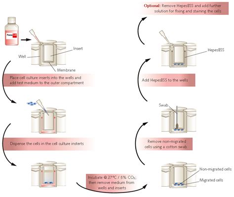 The Endothelial Cell Transwell Migration and Invasion Assay