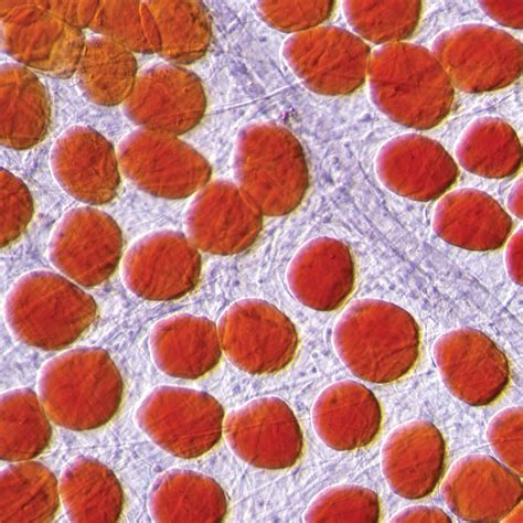 Mammal Adipose Tissue, w.m., Sudan-IV stain Microscope Slide | Carolina.com