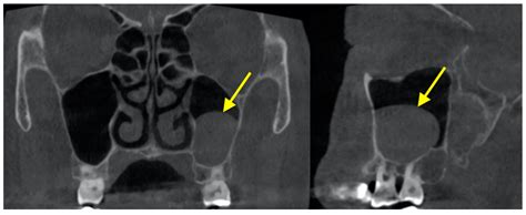 Diagnostics | Free Full-Text | The Use of CBCT in Evaluating the Health and Pathology of the ...