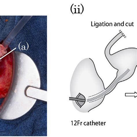 Postoperative cystography. Cystography was performed via the urinary... | Download Scientific ...