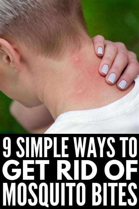 Stop The Itch! 9 Natural Mosquito Bite Remedies that Work | Remedies ...