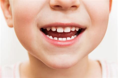 Caring For Your Child’s Teeth | Kids First Dentistry