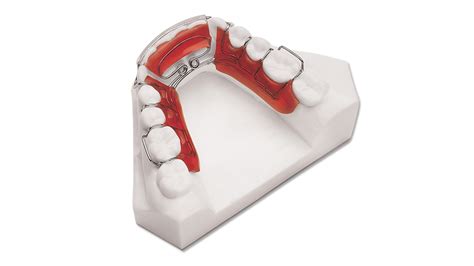 Spring Hawley Retainer Upper – Lower – BM Ortho Appliances Inc.