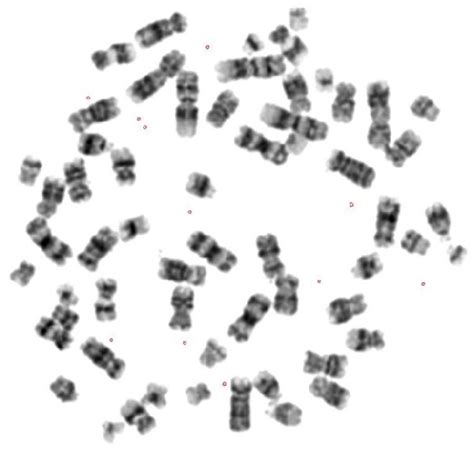 One of the 21 abnormal karyotype, showing... | Download Scientific Diagram