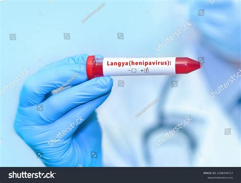 224 Henipavirus Images, Stock Photos & Vectors | Shutterstock