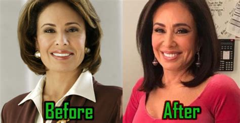 Jeanine Pirro Plastic Surgery: Facelift, Boob Job, Before After! - CelebritySurgeryIcon