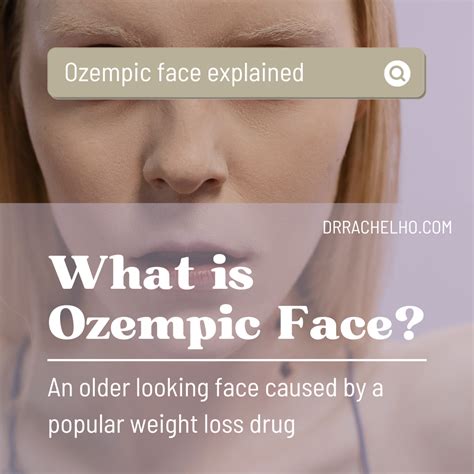 Dr Rachel Ho | ozempic face explained
