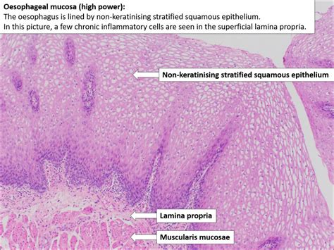 Oesophagus – Normal Histology – NUS Pathweb :: NUS Pathweb