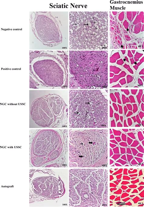 Histological Examination Of Hematoxylin And Eosin H E Stained Sciatic | Hot Sex Picture