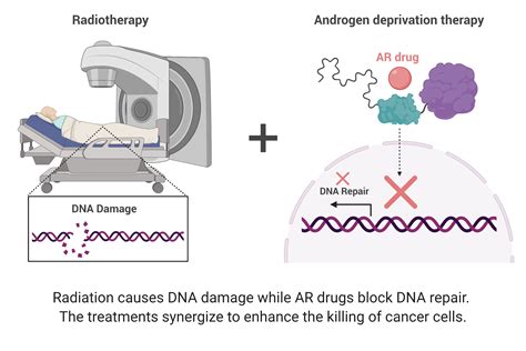 Cancer drug synergizes with radiation therapy in treatment-resistant prostate cancer | Genome ...