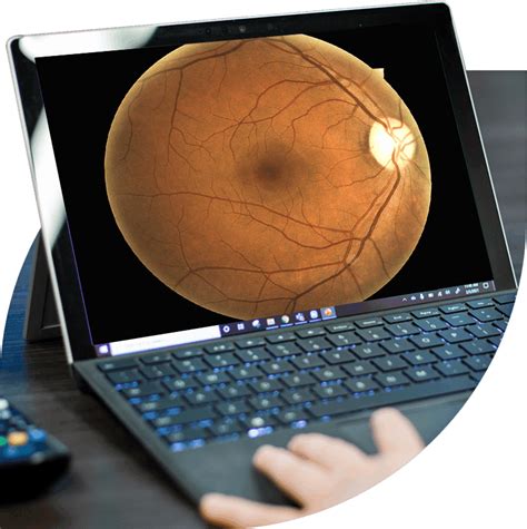 Retinal Screening Software & Diabetic Retinopathy Solutions