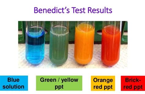 Benedict’s Test: Objective, Principle, Reagents, Procedure and Result