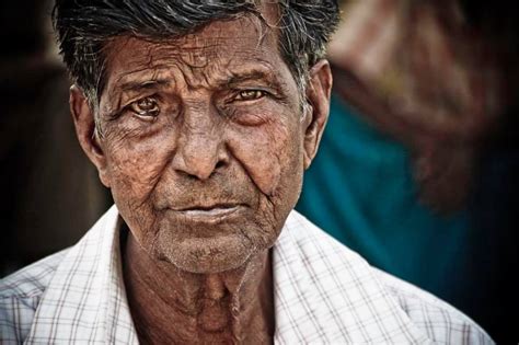 Leprosy: What It Is, What It’s Not, and How You Can Help - Embrace A Village