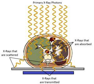 From X-Ray Beam to Image Signal – Digital Radiographic Exposure ...