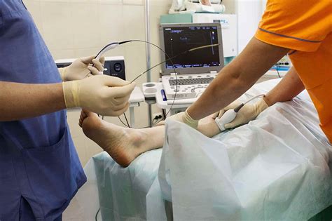 Radiofrequency Ablation For Varicose Veins | Vein Clinic Perth