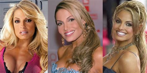 Trish Stratus Plastic Surgery Before and After Pictures 2024