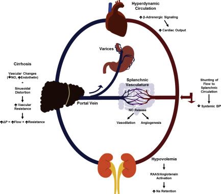 Portal Hypertension and Related Complications: Diagnosis and Management ...