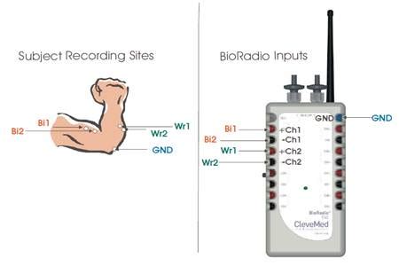 Emg Electrode Placement Guide