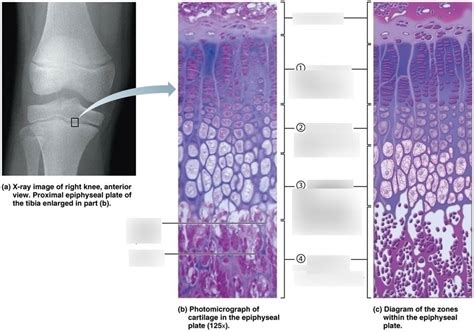 long bone growth Diagram | Quizlet