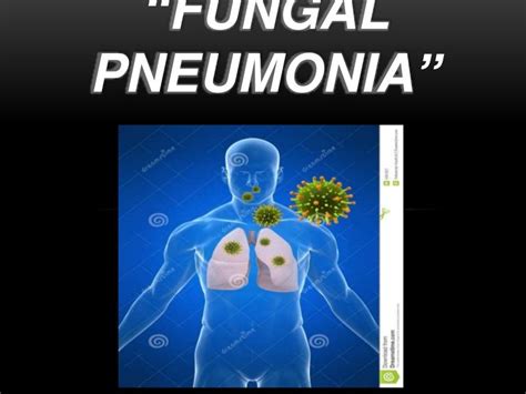 Fungal pneumonia