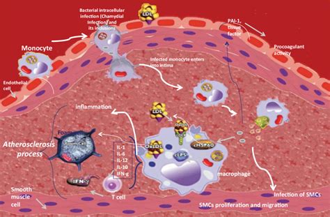 Principal players involved in atherogenesis: infections, inflammation,... | Download Scientific ...