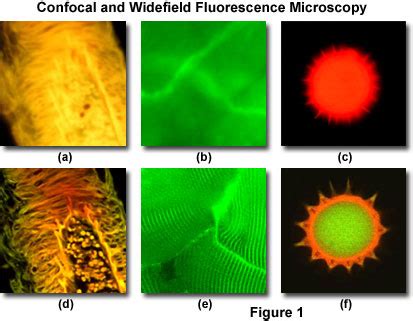 Confocal Microscopy - Introduction | Olympus LS