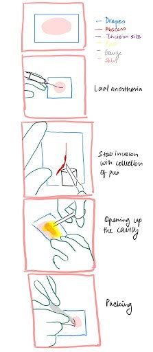 Medicowesome: Incision and drainage