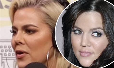 Khloe Kardashian sparks nose job speculation after selfies and recent ...