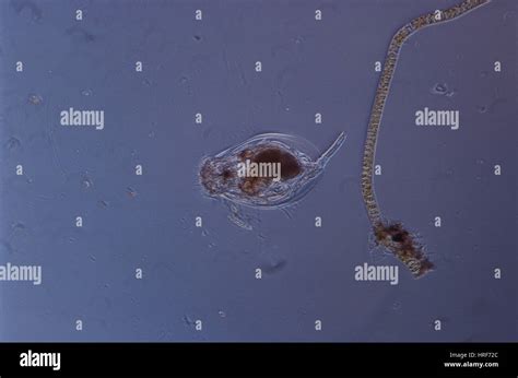 Rotifer, Euchlanus Species Stock Photo - Alamy