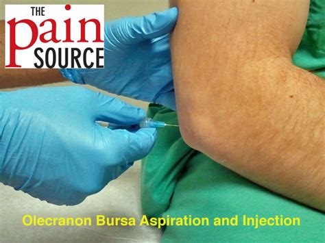 Cpt Code For Incision And Drainage Of Olecranon Bursa - Best Drain Photos Primagem.Org