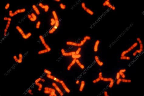 FISH micrograph of chromosomes - Stock Image - G210/1208 - Science ...