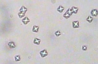 Calcium oxalate crystals found in urine samples of T. inunguis recorded ...