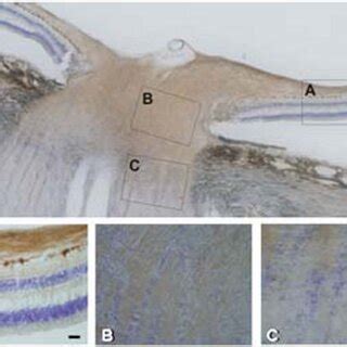 Representative overview of human retina and optic nerve immunostained ...