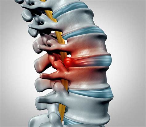 Cervical Spine Infection Treatment In Tamilnadu