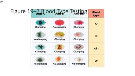 Blood Type Testing Diagram | Quizlet