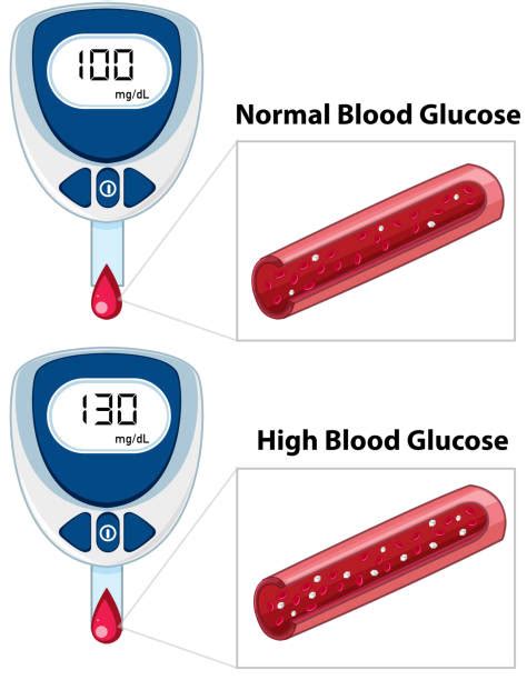 High Blood Sugar Illustrations, Royalty-Free Vector Graphics & Clip Art - iStock