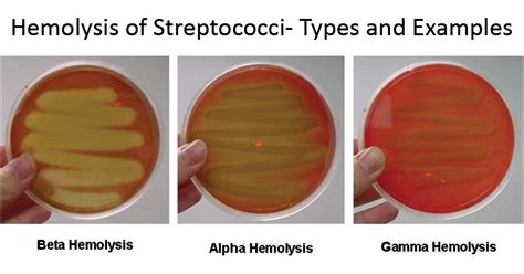 Blood Agar Alpha Beta Gamma