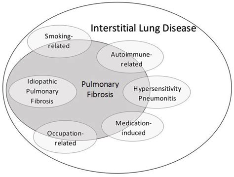 Interstitial Lung Disease Prognosis - slideshare