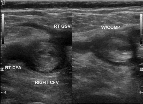 Grand Rounds Recap - 3/25/15 — Taming the SRU