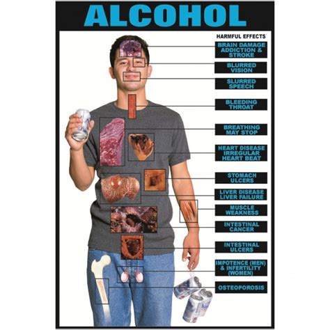 Medical Consequences of Alcohol Abuse