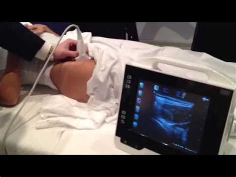 Ultrasound-Guided Hip Injection - YouTube