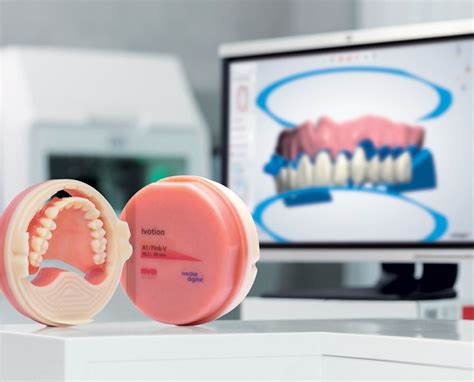 Dental Lab Products | Spectrum Dental