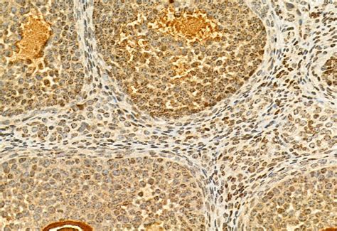 H3K27me3 Antibody (PA5-114540)