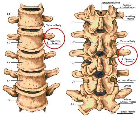 Transverse Process Fractures. A Broken Spine From Crashing